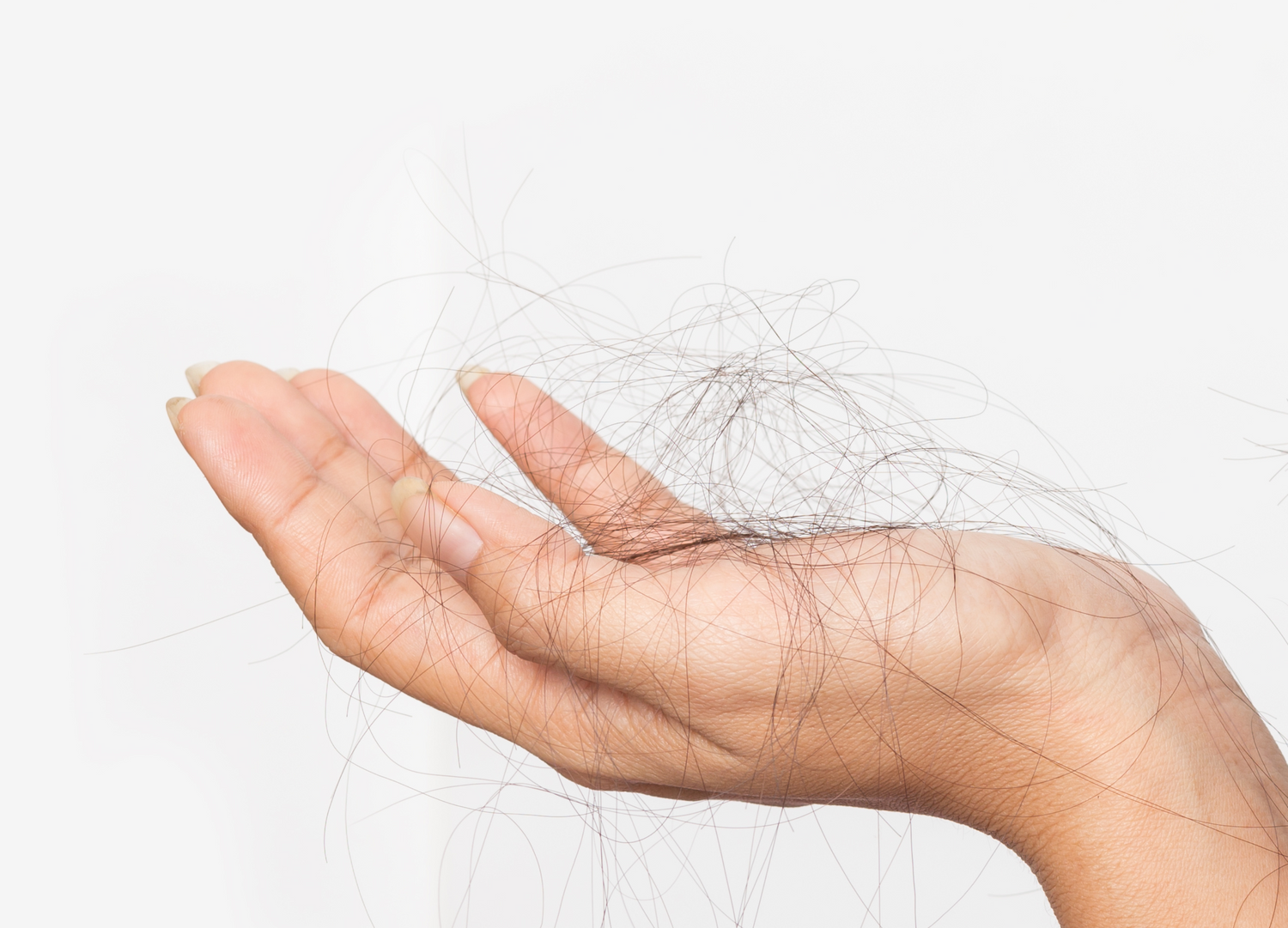 behandlung gegen haarausfall