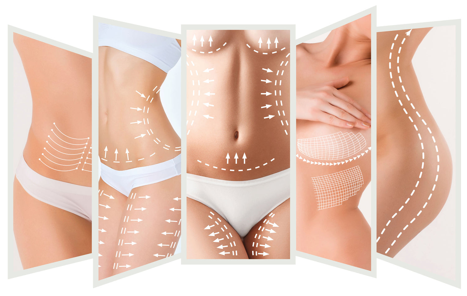cellulite behandlung