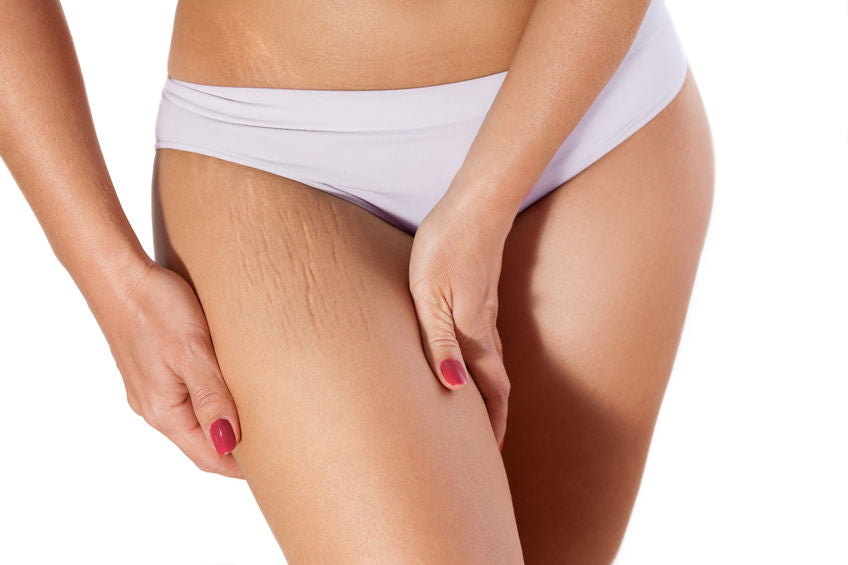 cellulite behandlung