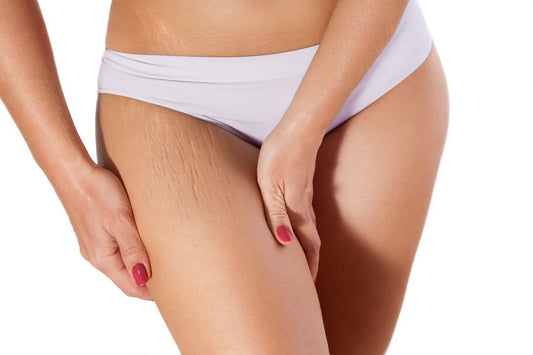 cellulite behandlung