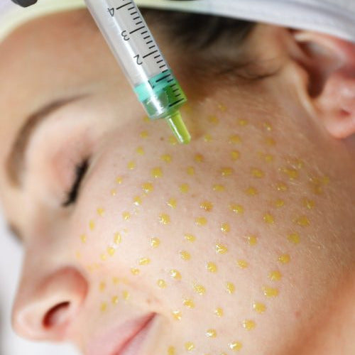 Bio Re Peel Behandlung